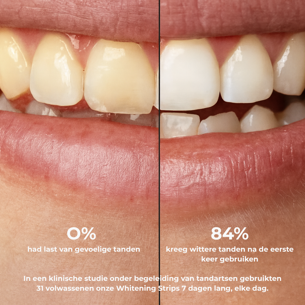 Dentora Pure White Strips