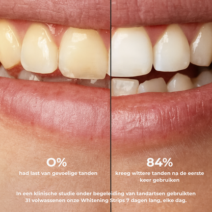 Dentora Pure White Strips